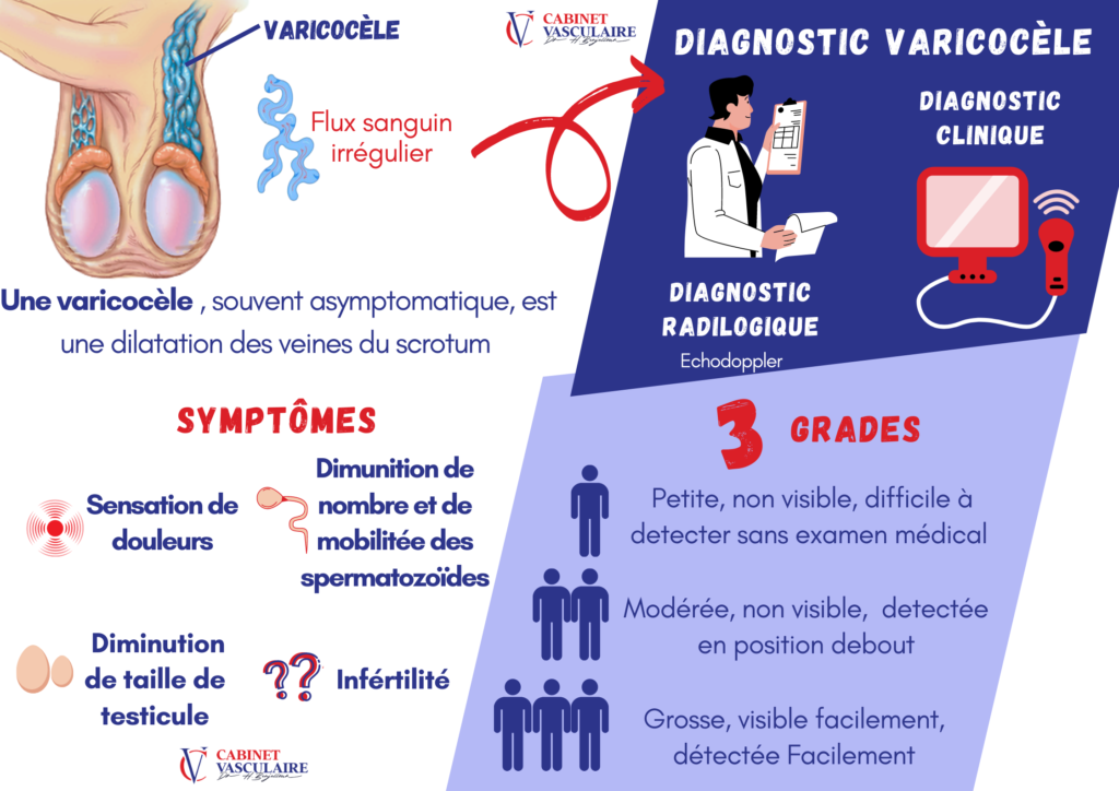 What is a Varicocele? - Causes, Symptoms & Treatment
